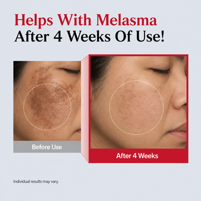Melasma Recovery Serum