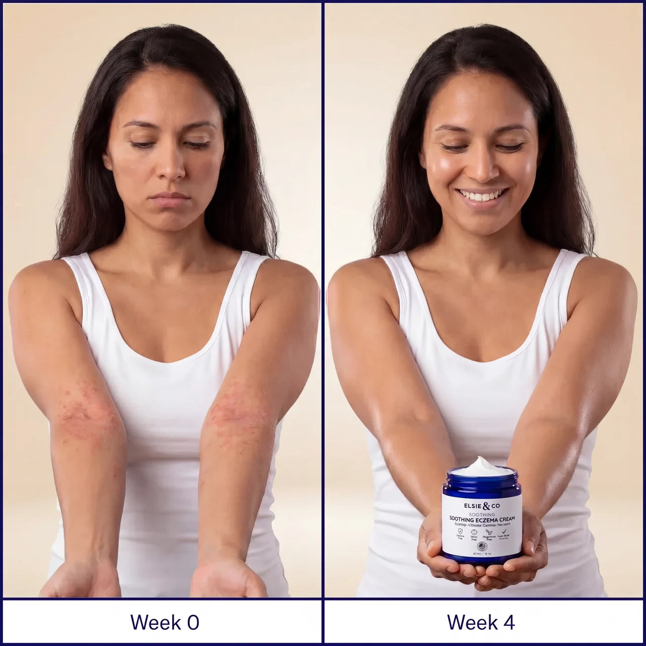 Dual Repair Eczema Cream